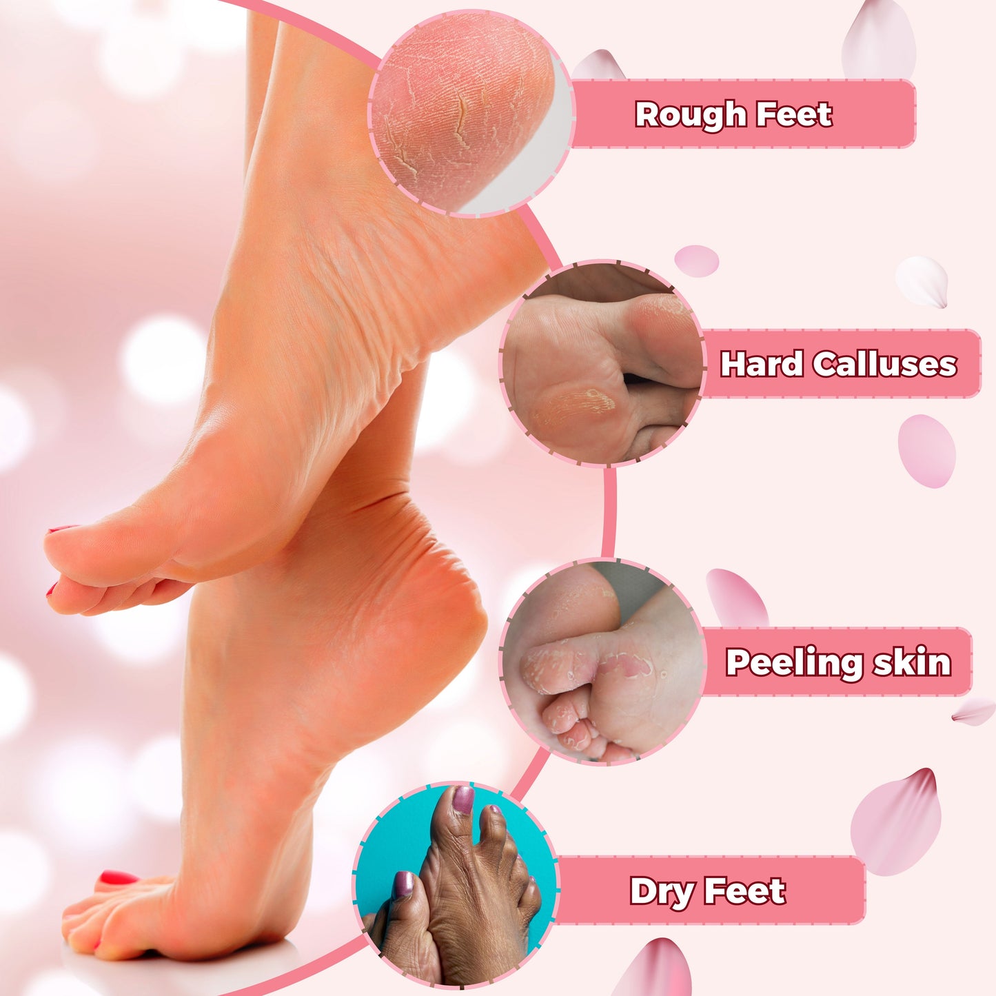 Moisturizing Socks for Dry Cracked Feet