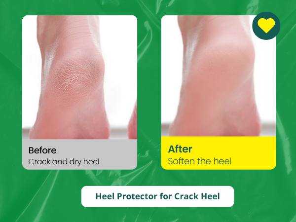 Silicone Heel Sleeve Socks - Moisturizing Gel Feet Heel Spur Pads Socks for Relief Heel Pain & Plantar Fasciitis
