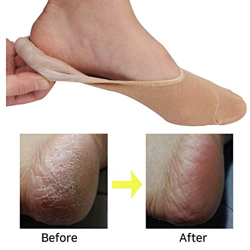 Gel No Shoe Socks – Therapeutic for Dry Cracked Feet – Relieve Heel Pain – Prevent Back Problems (Nude Color)