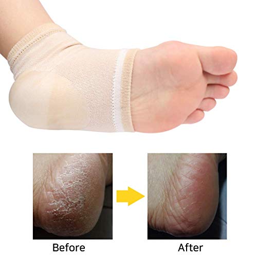 Spa Socks - Gel Heel Sleeves for Dry Cracked Feet – Silicone Moisturizing Socks (2 Pairs, Open Toe Style - Nude)