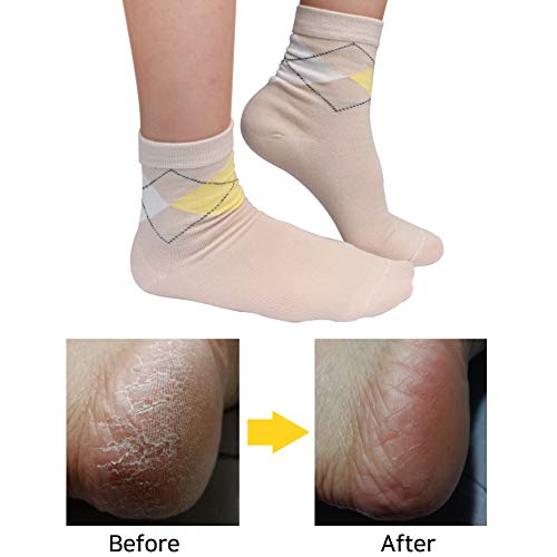 Spa Socks - Gel Heel Sleeves for Dry Cracked Feet – Silicone Moisturizing Socks (1 Pair, Normal Style - Nude)